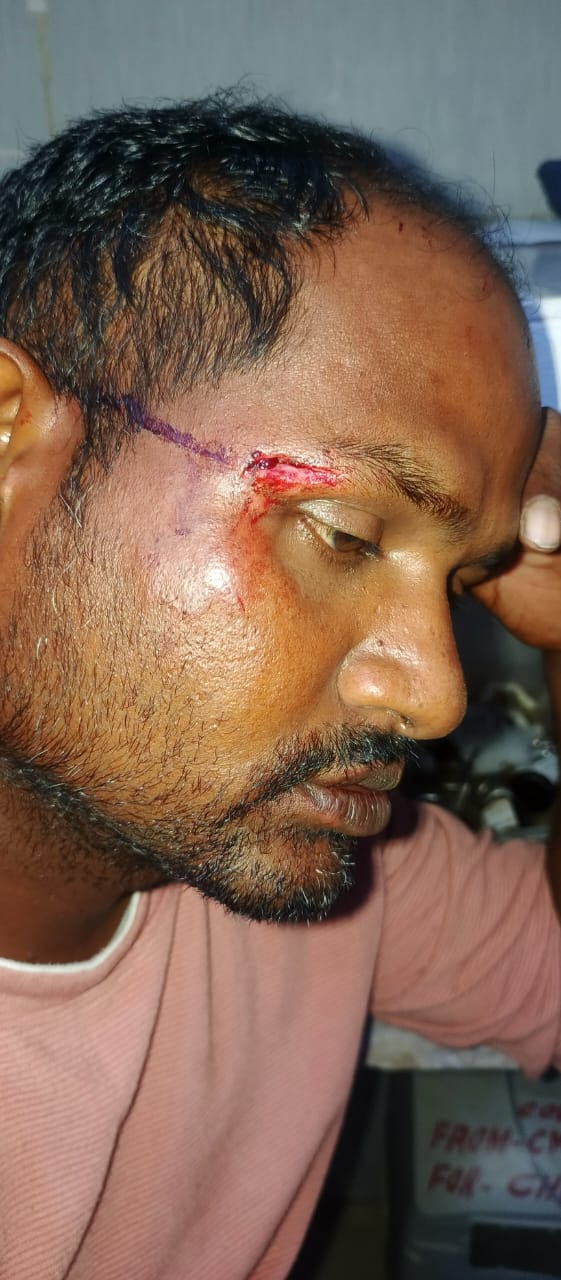 सामान लेकर मेला जा रहे जा रहे युवक को दबंगो ने लाठी डंडों से पीटा