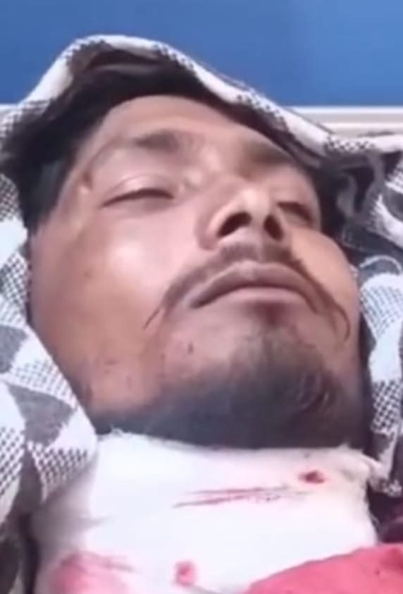 चाइनीज मांझे से युवक का कटा गला गंभीर हालत में प्राथमिक उपचार के बाद लखनऊ किया गया रेफर