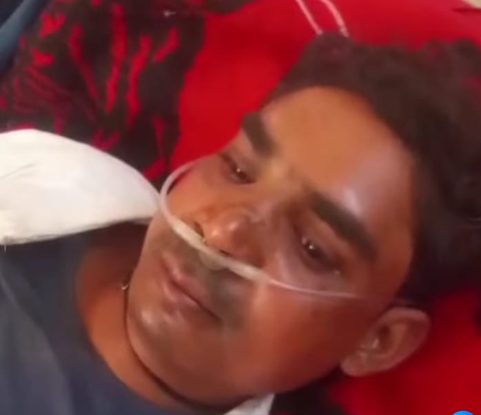 33 केवीए लाइन ठीक करते समय करंट की चपेट आया कर्मचारी, झुलसा